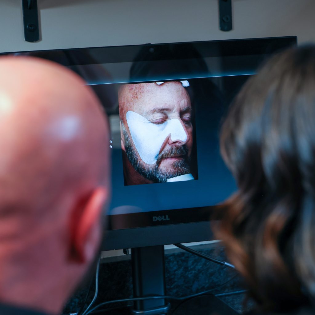 Close-up view of a digital skin analysis image showing a male client’s face on a monitor, reviewed by a provider and patient during a MedSpa consultation.